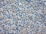 BUB1B Antibody in Immunohistochemistry (Paraffin) (IHC (P))