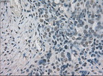 BUB1B Antibody in Immunohistochemistry (Paraffin) (IHC (P))