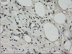 BUB1B Antibody in Immunohistochemistry (Paraffin) (IHC (P))