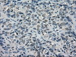 BUB1B Antibody in Immunohistochemistry (Paraffin) (IHC (P))