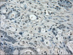 BUB1B Antibody in Immunohistochemistry (Paraffin) (IHC (P))