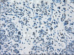 BUB1B Antibody in Immunohistochemistry (Paraffin) (IHC (P))