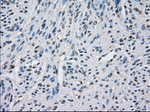 BUB1B Antibody in Immunohistochemistry (Paraffin) (IHC (P))