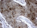 BUB1B Antibody in Immunohistochemistry (Paraffin) (IHC (P))