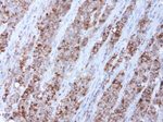 BUB1B Antibody in Immunohistochemistry (Paraffin) (IHC (P))