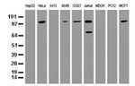 BUB1B Antibody in Western Blot (WB)