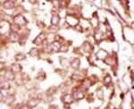 BUBR1 Antibody in Immunohistochemistry (IHC)