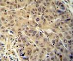 BUD13 Antibody in Immunohistochemistry (IHC)
