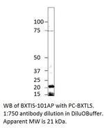 Beta crystallin S Polyclonal Antibody