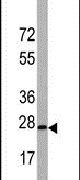 BarX1 Antibody in Western Blot (WB)