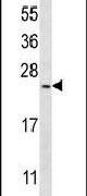 BarX1 Antibody in Western Blot (WB)