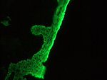 Cytokeratin 5 Monoclonal Antibody (RCK103)