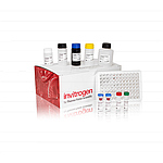Mouse Basic IL-6 ELISA Kit (ECM007)