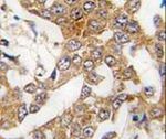 Bcl-W Antibody in Immunohistochemistry (IHC)
