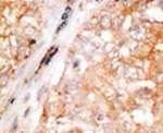 Bcl-W Antibody in Immunohistochemistry (IHC)