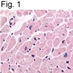 beta-2 Adrenergic Receptor Antibody in Immunohistochemistry (IHC)