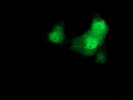 Beta-catenin Antibody in Immunocytochemistry (ICC/IF)