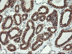 Beta-catenin Antibody in Immunohistochemistry (Paraffin) (IHC (P))