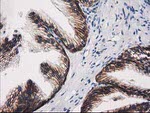 Beta-catenin Antibody in Immunohistochemistry (Paraffin) (IHC (P))
