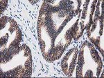 Beta-catenin Antibody in Immunohistochemistry (Paraffin) (IHC (P))