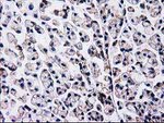 Beta-catenin Antibody in Immunohistochemistry (Paraffin) (IHC (P))