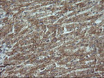 Beta-catenin Antibody in Immunohistochemistry (Paraffin) (IHC (P))