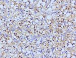 Beta-catenin Antibody in Immunohistochemistry (Paraffin) (IHC (P))