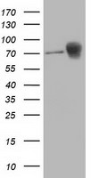 Beta-catenin Antibody in Western Blot (WB)