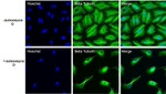 beta Tubulin Antibody in Immunocytochemistry (ICC/IF)