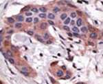 BID Antibody in Immunohistochemistry (IHC)