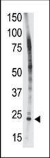 BID Antibody in Western Blot (WB)