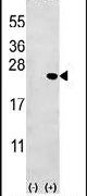 BID Antibody in Western Blot (WB)