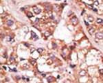 BIK Antibody in Immunohistochemistry (IHC)