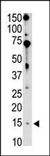 BIK Antibody in Western Blot (WB)