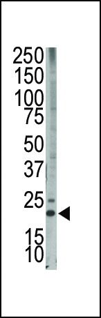 Bim Antibody in Western Blot (WB)