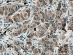 DNAJB9 Antibody in Immunohistochemistry (Paraffin) (IHC (P))