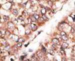 BMP-3 Antibody in Immunohistochemistry (IHC)