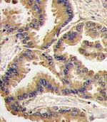BMP-6 Antibody in Immunohistochemistry (IHC)