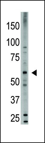 BMP-6 Antibody in Western Blot (WB)
