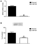 Bombesin Receptor 3 Antibody in Western Blot (WB)