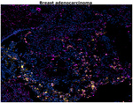 CD68 Antibody in Immunohistochemistry (Paraffin) (IHC (P))