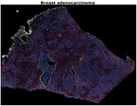 CD68 Antibody in Immunohistochemistry (Paraffin) (IHC (P))