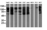 BuB1B Antibody in Western Blot (WB)