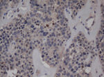 C-Jun Antibody in Immunohistochemistry (Paraffin) (IHC (P))
