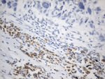 C10orf54 Antibody in Immunohistochemistry (Paraffin) (IHC (P))