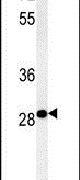 C11orf46 Antibody in Western Blot (WB)