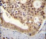 C11orf53 Antibody in Immunohistochemistry (IHC)