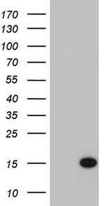 C11orf67 Antibody in Western Blot (WB)