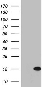 C11orf67 Antibody in Western Blot (WB)