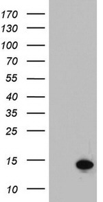 C11orf67 Antibody in Western Blot (WB)